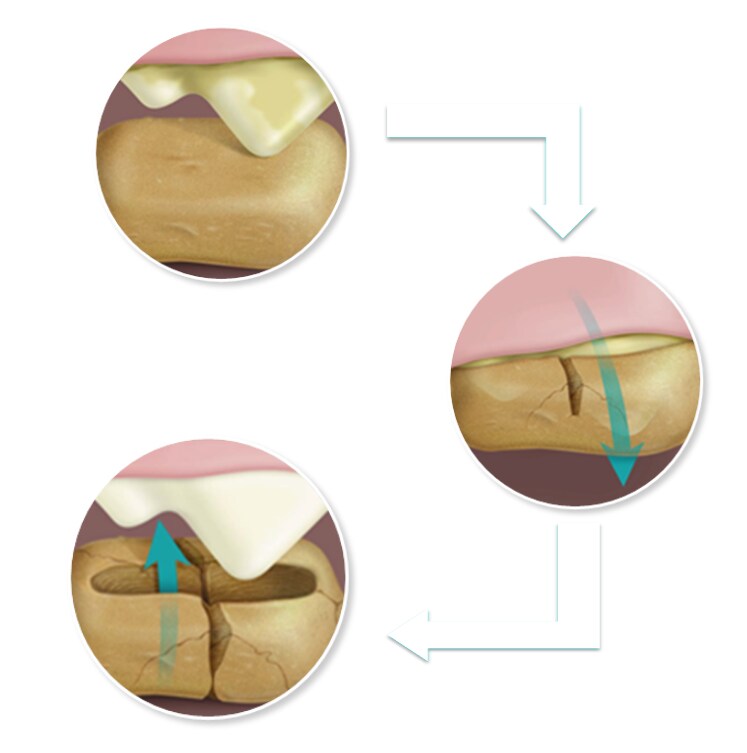 Diagram showing how Hill's Dental diets work