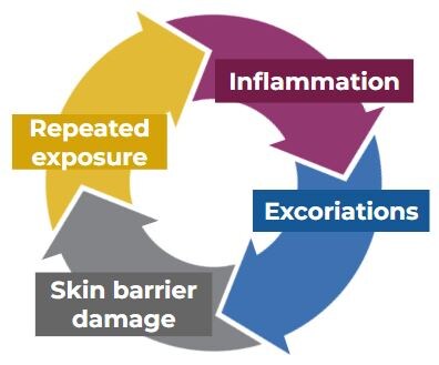 The vicious cycle of canine atopic dermatitis.